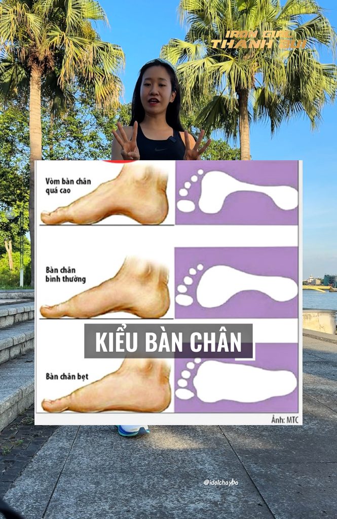 Các kiểu bàn chân